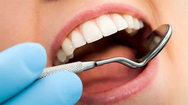 Treatment of Cavity