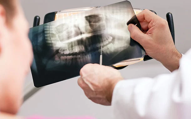 Digital X-Ray