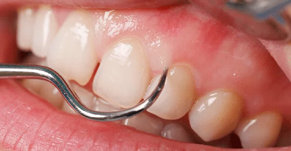 Periodontology